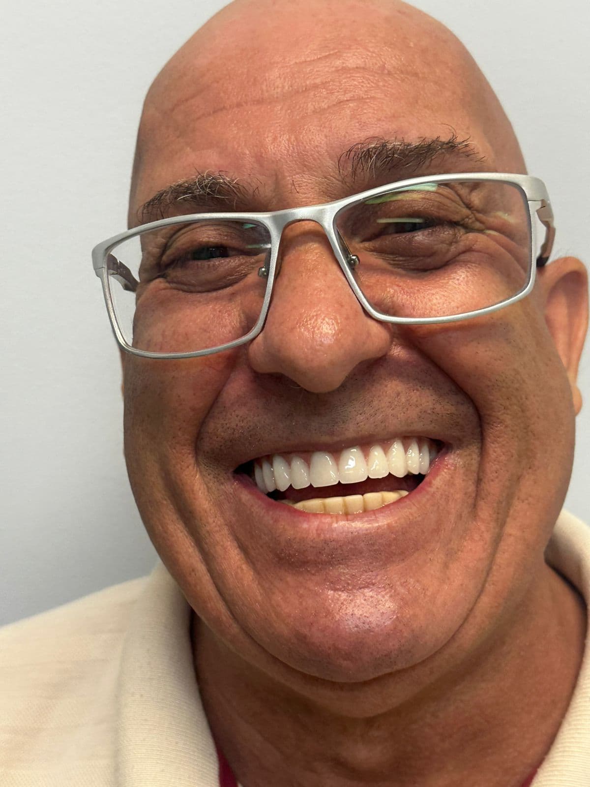 Depois do tratamento